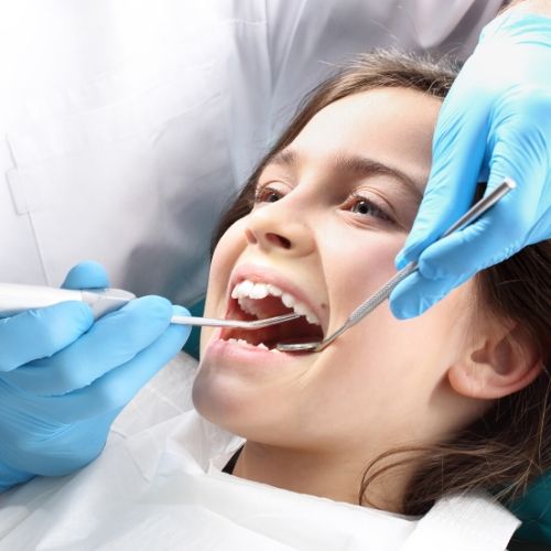 Dental Sealant Image